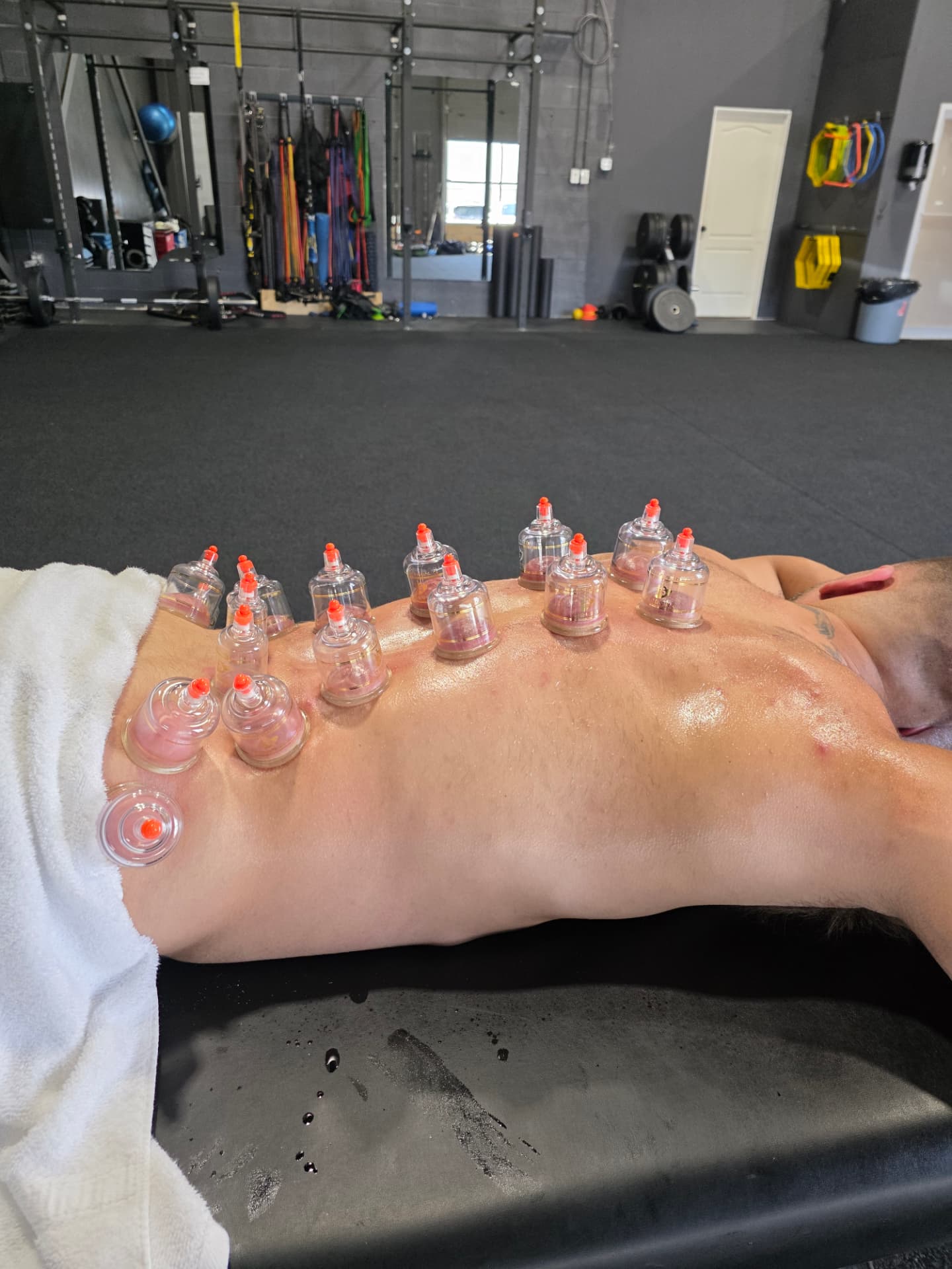 Cupping therapy recovery session at Comega
